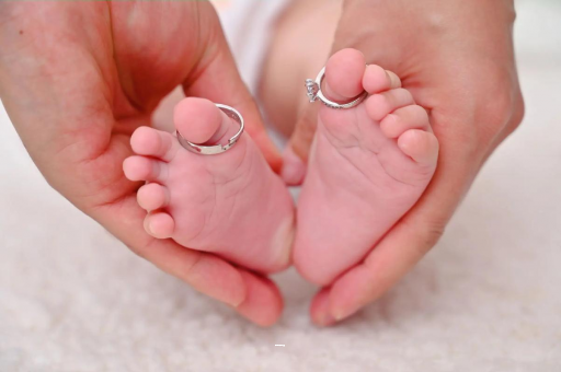 红河孕妇怎样预防妊娠纹